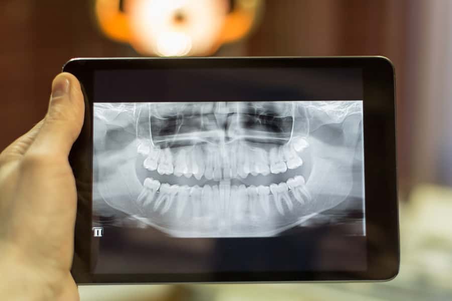 Digital Radiography in Hinsdale, IL