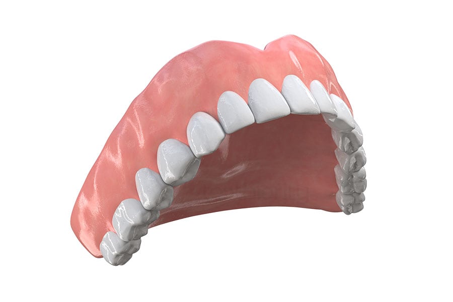 Traditional denture comparison