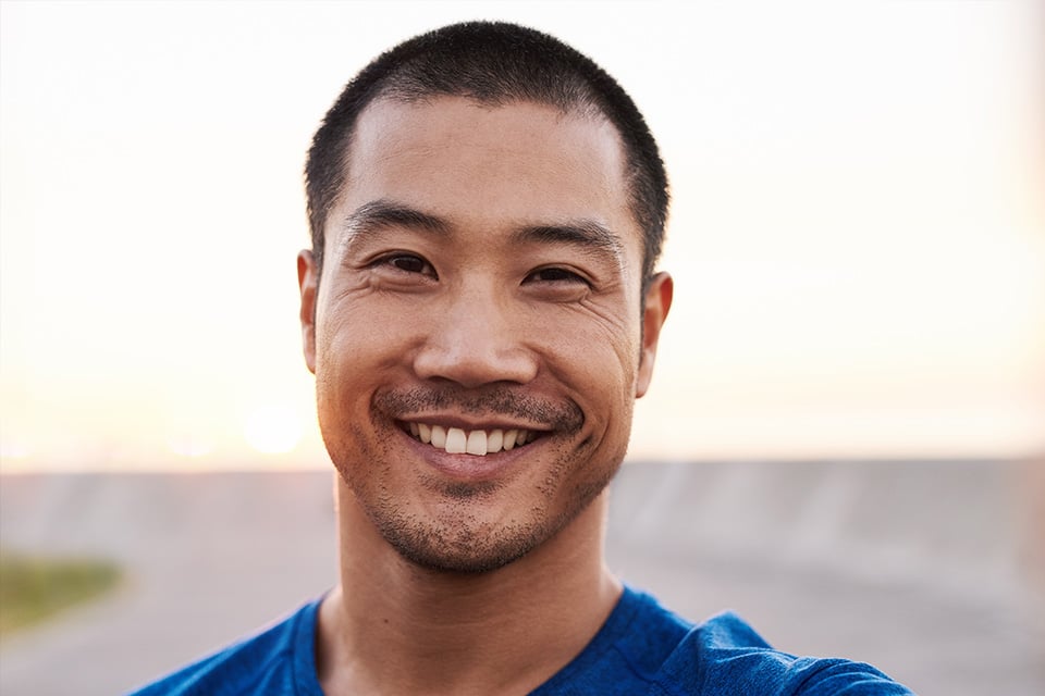 Minimal prep veneers at Hinsdale Dental Journey